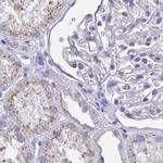 CHMP5 Antibody in Immunohistochemistry (IHC)