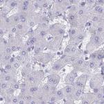 CHMP5 Antibody in Immunohistochemistry (IHC)