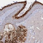 ELOVL1 Antibody in Immunohistochemistry (IHC)