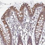 ELOVL1 Antibody in Immunohistochemistry (IHC)