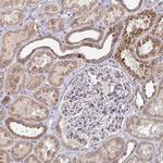 ELOVL1 Antibody in Immunohistochemistry (IHC)