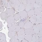 ELOVL1 Antibody in Immunohistochemistry (IHC)