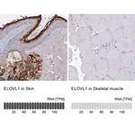 ELOVL1 Antibody