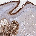 ELOVL1 Antibody in Immunohistochemistry (IHC)