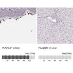 PLA2G4F Antibody in Immunohistochemistry (IHC)