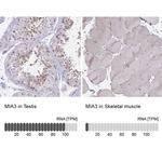 MIA3 Antibody in Immunohistochemistry (IHC)