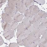 MIA3 Antibody in Immunohistochemistry (IHC)