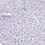 PGM2L1 Antibody in Immunohistochemistry (IHC)