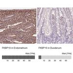 FKBP10 Antibody in Immunohistochemistry (IHC)