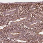 FKBP10 Antibody in Immunohistochemistry (IHC)