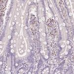 FKBP10 Antibody in Immunohistochemistry (IHC)