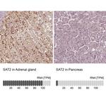 SAT2 Antibody in Immunohistochemistry (IHC)