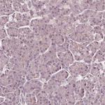 SAT2 Antibody in Immunohistochemistry (IHC)