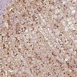 SAT2 Antibody in Immunohistochemistry (IHC)