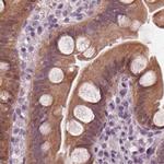 SAT2 Antibody in Immunohistochemistry (IHC)