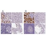 V-ATPase D Antibody in Immunohistochemistry (IHC)