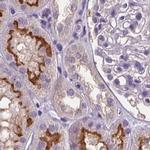 V-ATPase D Antibody in Immunohistochemistry (IHC)