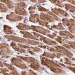 ATP Synthase B1 Antibody in Immunohistochemistry (IHC)