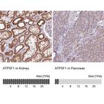 ATP Synthase B1 Antibody