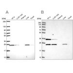 ATP Synthase B1 Antibody in Western Blot (WB)