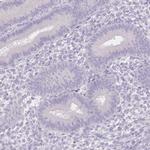 SUV39H2 Antibody in Immunohistochemistry (IHC)