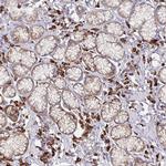 YARS2 Antibody in Immunohistochemistry (IHC)