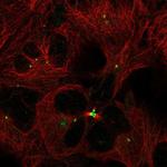 TMEM86B Antibody in Immunocytochemistry (ICC/IF)