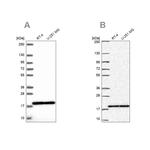 RPS15 Antibody in Western Blot (WB)