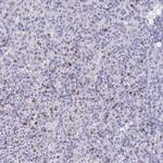 Granulysin Antibody in Immunohistochemistry (IHC)