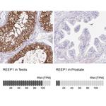 REEP1 Antibody in Immunohistochemistry (IHC)