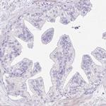 REEP1 Antibody in Immunohistochemistry (IHC)