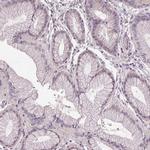 SLC26A2 Antibody in Immunohistochemistry (IHC)