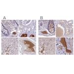 HGF Activator Antibody in Immunohistochemistry (IHC)