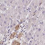 HGF Activator Antibody in Immunohistochemistry (IHC)