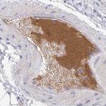 HGF Activator Antibody in Immunohistochemistry (IHC)