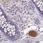 HGF Activator Antibody in Immunohistochemistry (IHC)