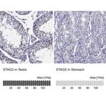 STAG3 Antibody in Immunohistochemistry (IHC)