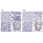 STAG3 Antibody in Immunohistochemistry (IHC)