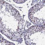 STAG3 Antibody in Immunohistochemistry (IHC)