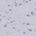 STAG3 Antibody in Immunohistochemistry (IHC)