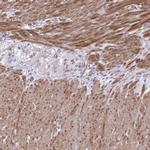 LIMS2 Antibody in Immunohistochemistry (IHC)