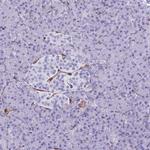 LIMS2 Antibody in Immunohistochemistry (IHC)