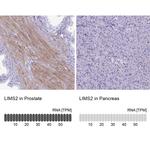 LIMS2 Antibody