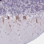 TMEM106B Antibody in Immunohistochemistry (IHC)