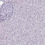 TTC7B Antibody in Immunohistochemistry (IHC)