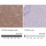 TTC7B Antibody