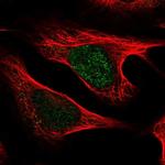 UXT Antibody in Immunocytochemistry (ICC/IF)