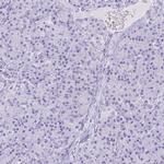 NGB Antibody in Immunohistochemistry (IHC)