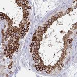 DPEP3 Antibody in Immunohistochemistry (IHC)