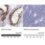 DPEP3 Antibody